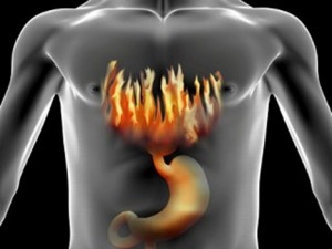 acidez estomago homeopatia acidez estomago 300x225 ¿Cómo tratar la acidez de estómago con homeopatía?